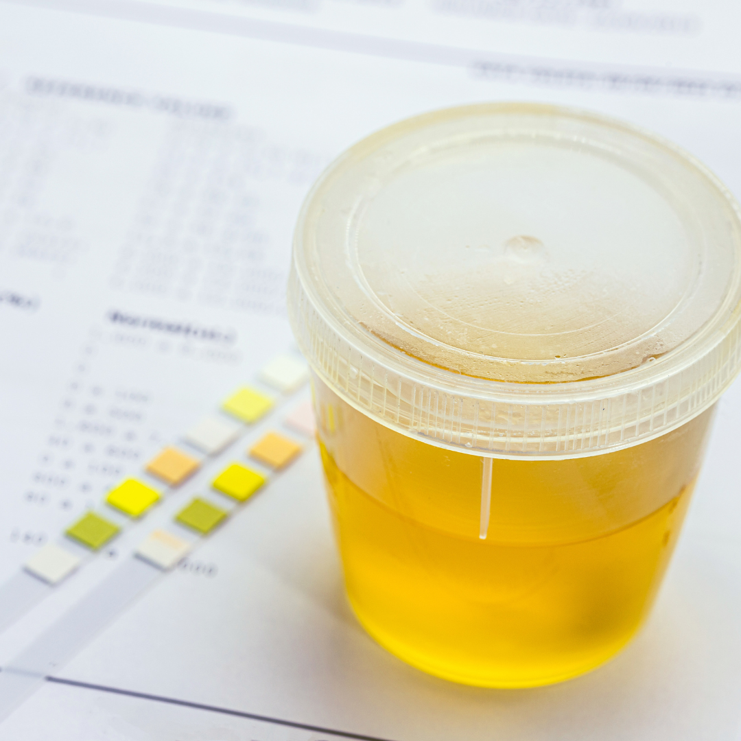 Interpretação de Urinálise – EAD